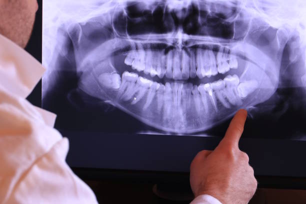 Best Emergency Tooth Extraction in Fremont, MI