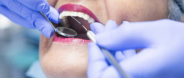Best Emergency Tooth Extraction in Fremont, MI