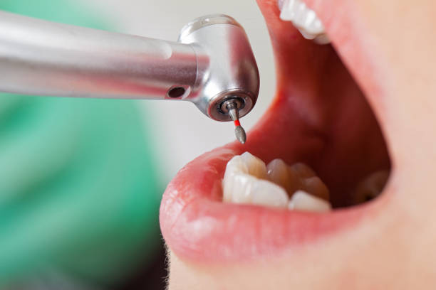 Best Emergency Treatment for Toothache in Fremont, MI